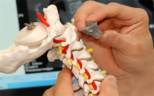 数字图像相关法(DIC)骨骼新材料力学性能测试.png 数字图像相关法(DIC)骨骼新材料力学性能测试.png