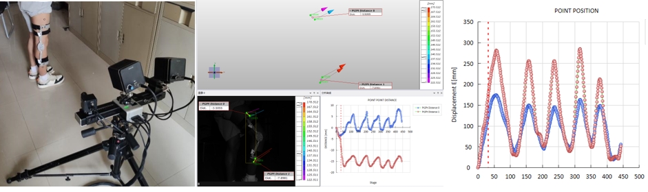 数字图像相关(DIC)技术用于腿部支架运动位移测量.jpg 数字图像相关(DIC)技术用于腿部支架运动位移测量.jpg